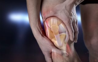 Aufbau und Behandlung von Knieschmerzen