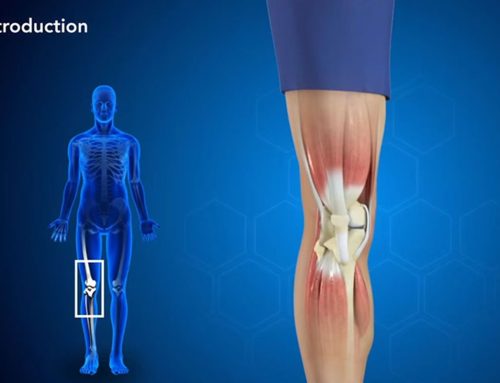 Video über die Anatomie des Kniegelenks